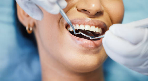 Best Emergency Tooth Extraction in Genola, UT