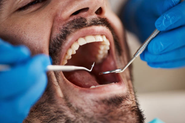 Best Emergency Tooth Extraction in Genola, UT